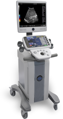 SonixTouch Research ultrasound system