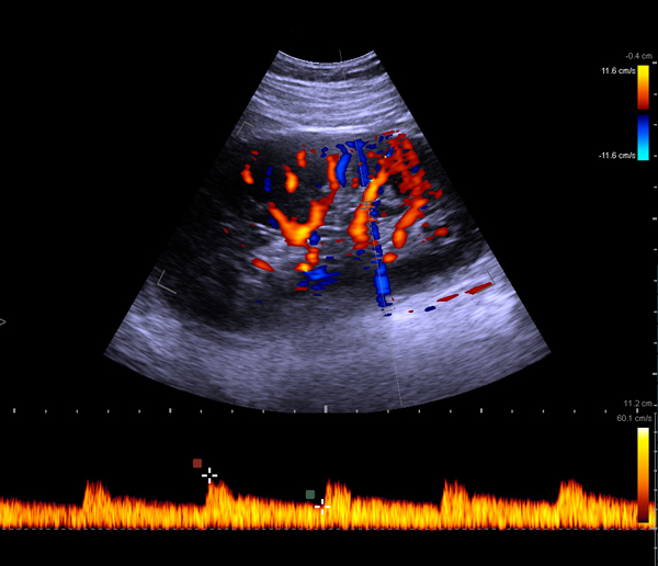 Ultrasound Machines for Kidney Imaging Medical