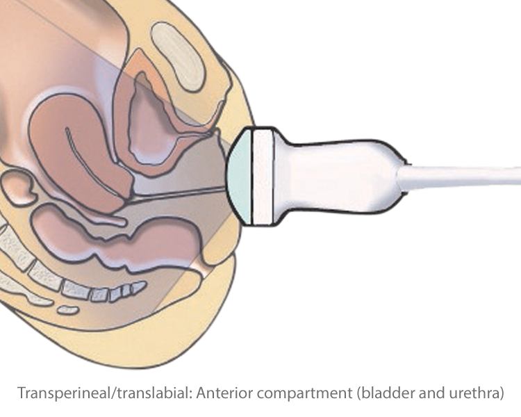 Transperineal/translabial: Anterior compartment (bladder and urethra)